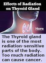 Most nuclear accidents release radioactive iodine into the atmosphere, which can be absorbed into the body. When thyroid cells absorb too much radioactive iodine, it can cause thyroid cancer to develop several years after the exposure. Babies and young children are at highest risk. The risk is much lower for people over 40. Thyroid cancer seems to be the only cancer whose incidence rises after a radioactive iodine release.